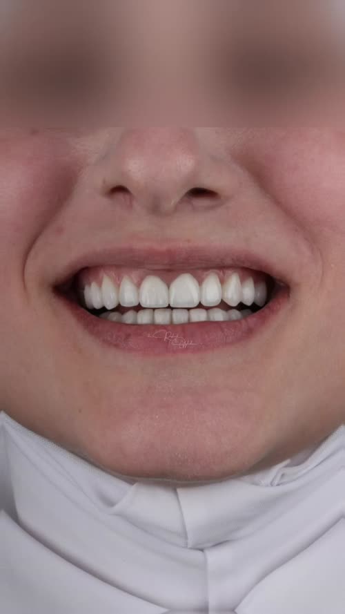 Preview of Dental / Patient story