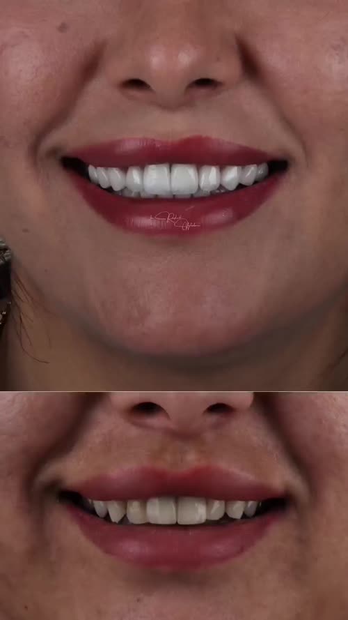 Preview of We Smile / Smile story